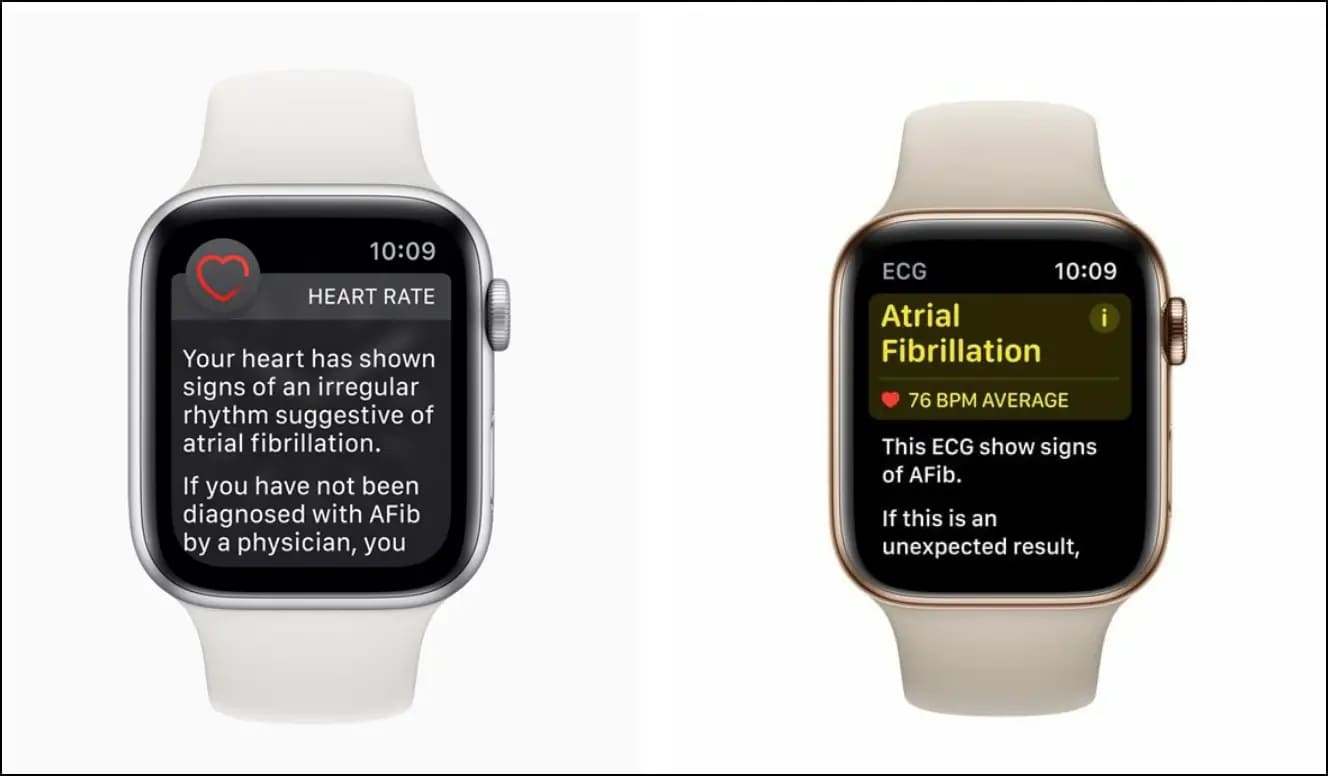 Atrial Fibrillation Warning on Apple Watch